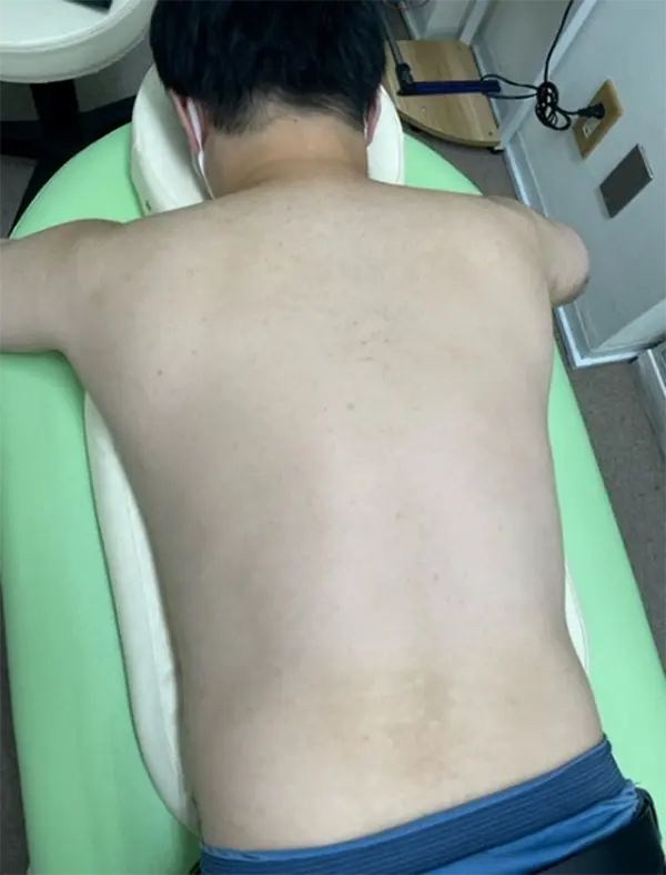 施術前