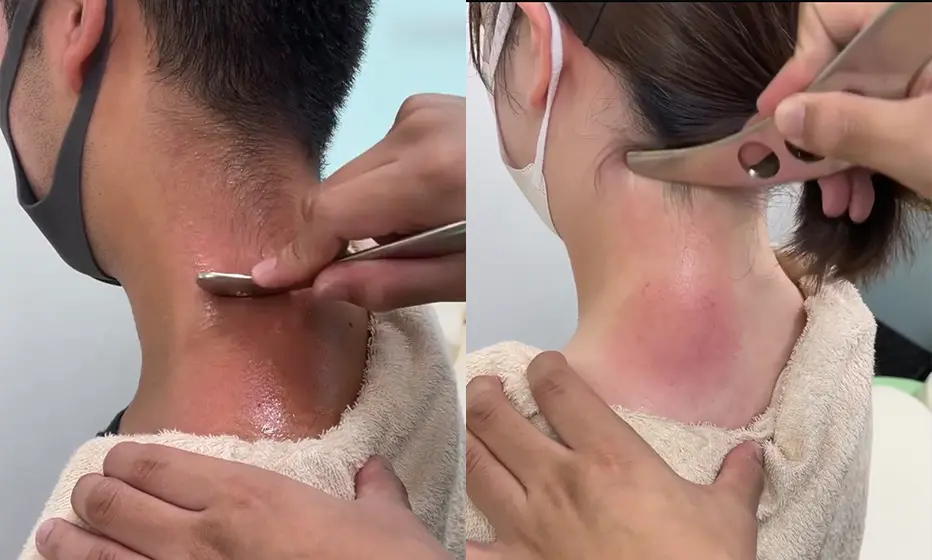 カッサが特に効果的な症状
