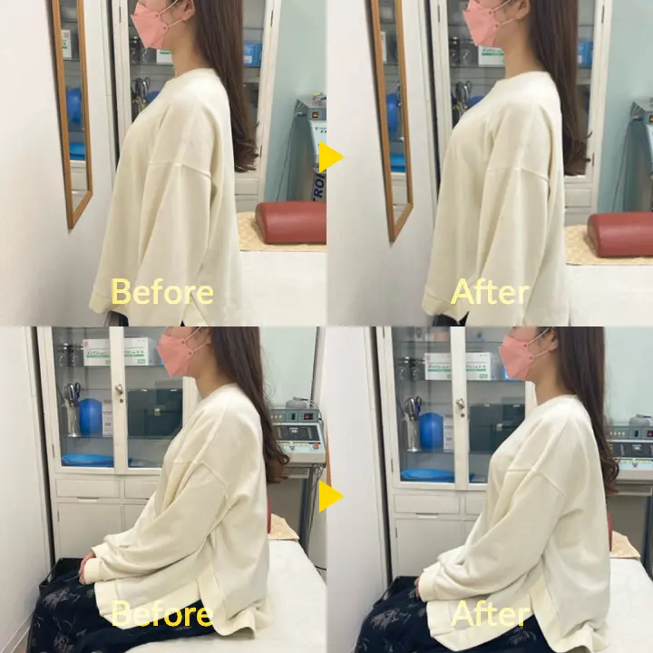 ビフォー・アフター